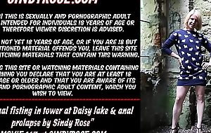 Self anal fisting in tower at one's disposal Daisy lake and anal prolapse apart distance from Sindy Rose-coloured